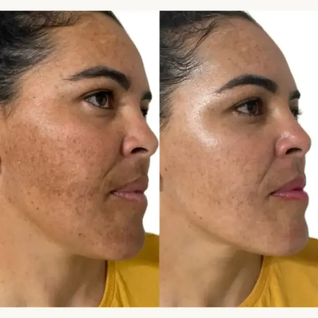 Foto de antes e depois de uma cliente, 1 de 24
