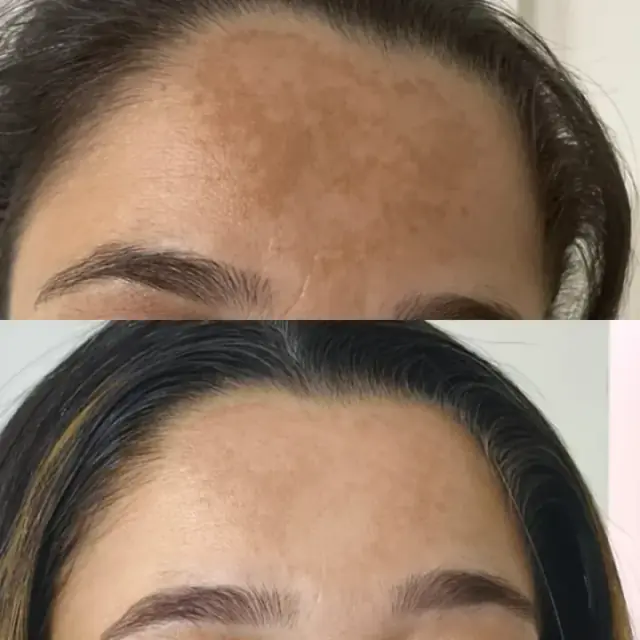 Foto de antes e depois de uma cliente, 2 de 24