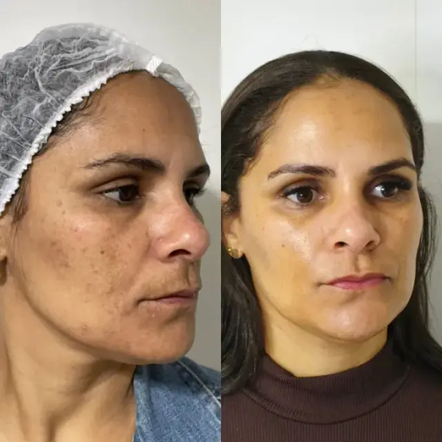 Foto de antes e depois de uma cliente, 3 de 24