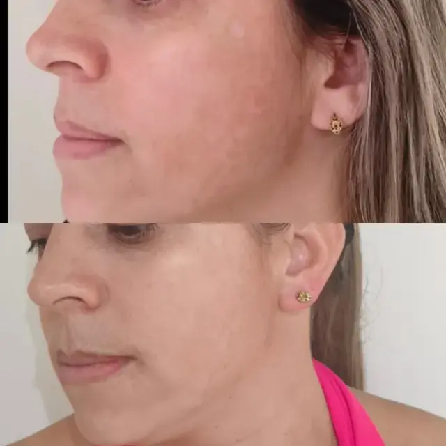 Foto de antes e depois de uma cliente, 5 de 24