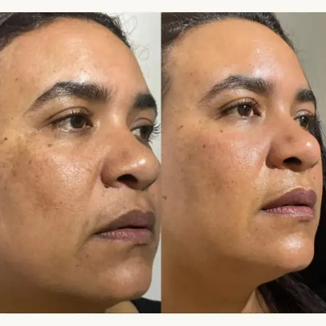 Foto de antes e depois de uma cliente, 6 de 24