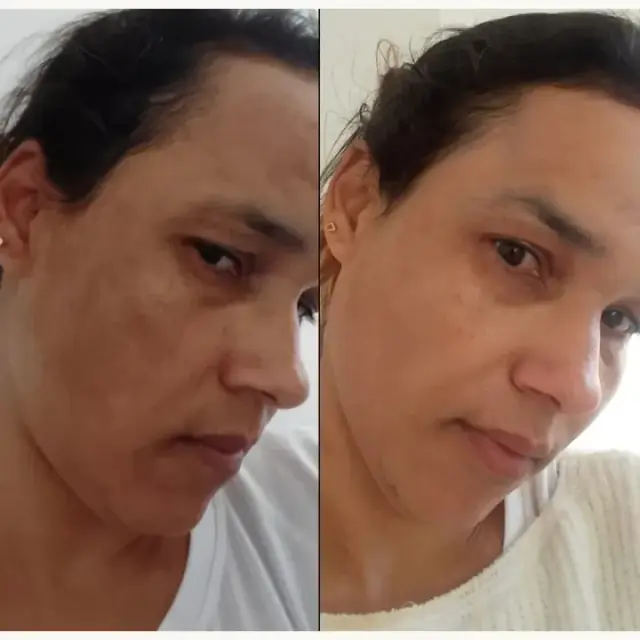 Foto de antes e depois de uma cliente, 7 de 24