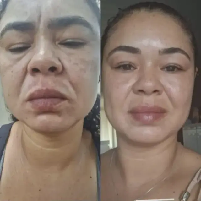 Foto de antes e depois de uma cliente, 8 de 24
