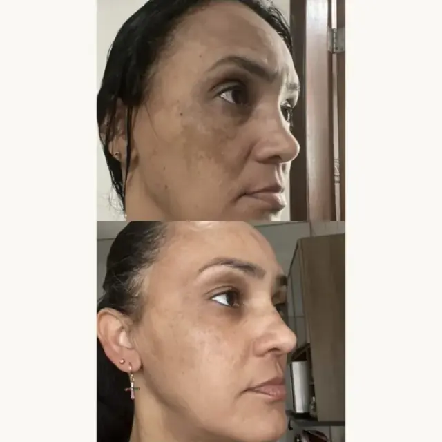 Foto de antes e depois de uma cliente, 10 de 24