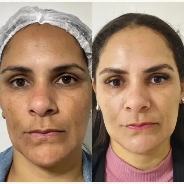 Foto de antes e depois de uma cliente, 11 de 24