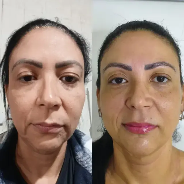 Foto de antes e depois de uma cliente, 12 de 24
