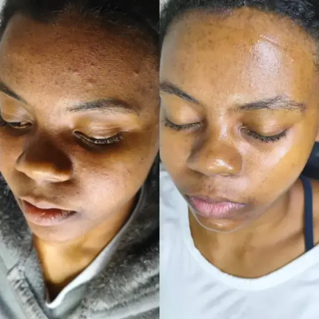 Foto de antes e depois de uma cliente, 13 de 24