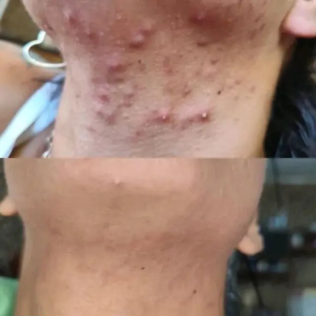 Foto de antes e depois de uma cliente, 14 de 24