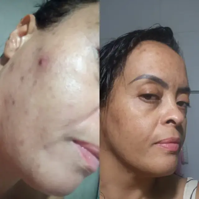 Foto de antes e depois de uma cliente, 15 de 24