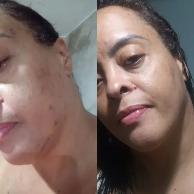 Foto de antes e depois de uma cliente, 16 de 24
