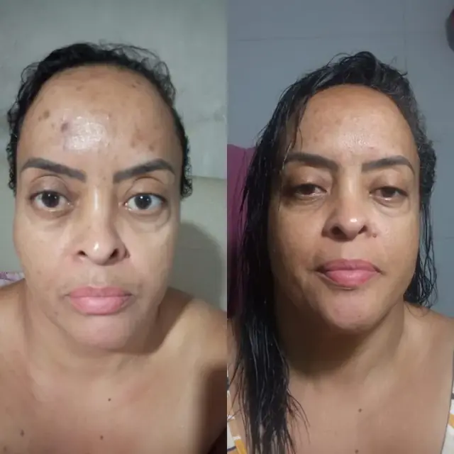 Foto de antes e depois de uma cliente, 17 de 24
