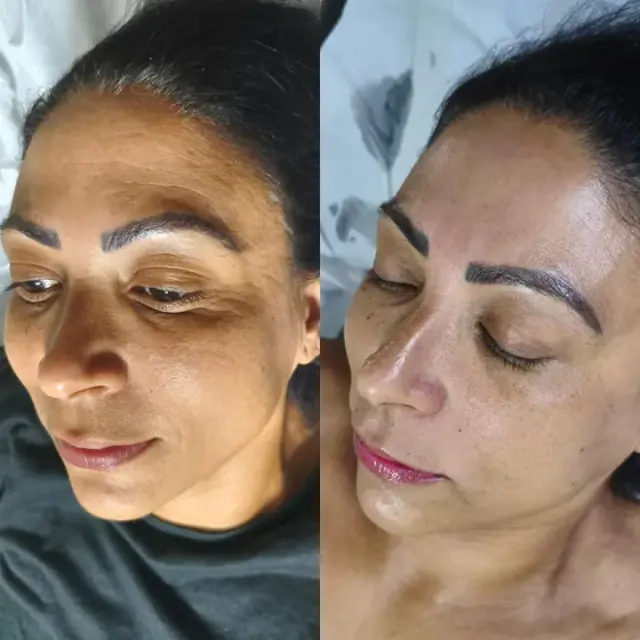 Foto de antes e depois de uma cliente, 18 de 24