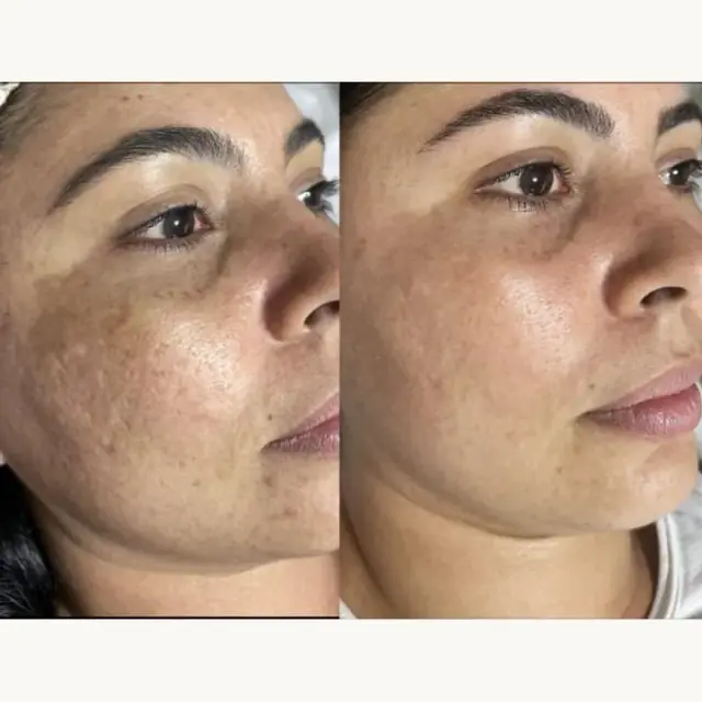 Foto de antes e depois de uma cliente, 19 de 24