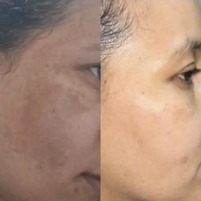 Foto de antes e depois de uma cliente, 20 de 24