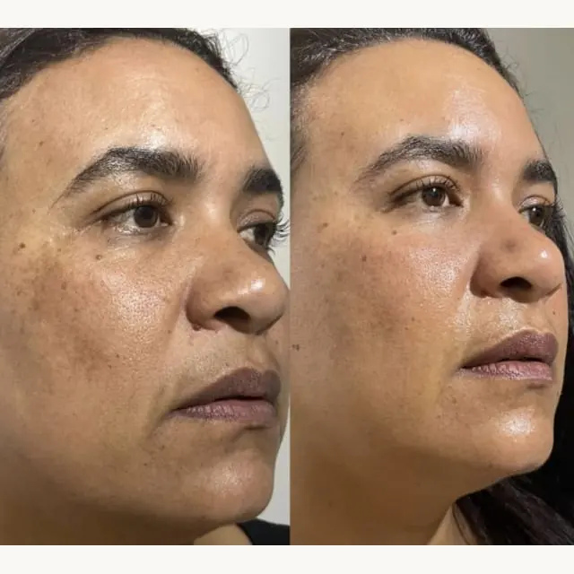Foto de antes e depois de uma cliente, 21 de 24