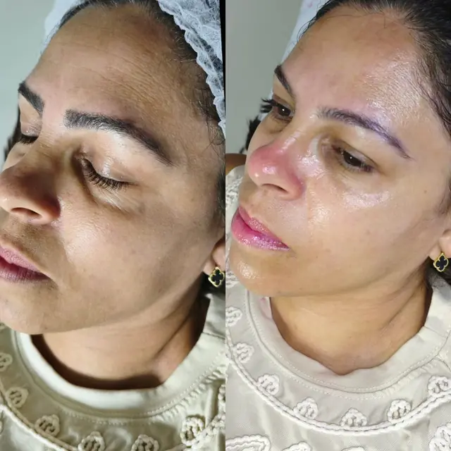 Foto de antes e depois de uma cliente, 22 de 24