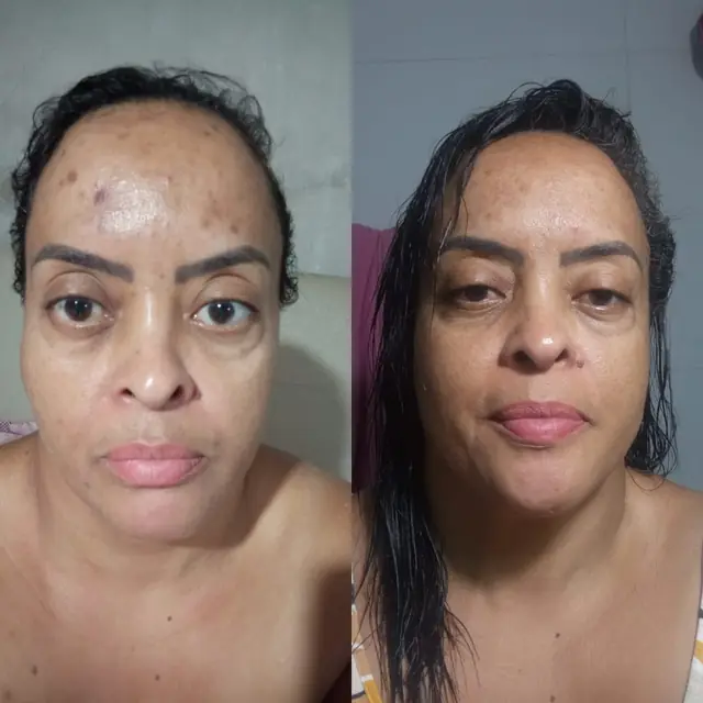 Foto de antes e depois de uma cliente, 23 de 24