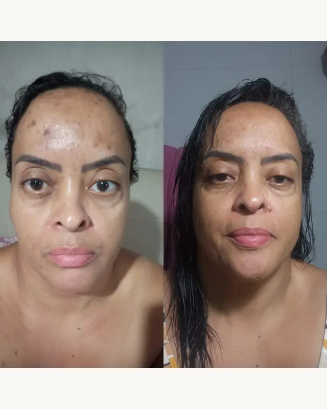 Protocolo DermAna: frascos de Renova Skin, Sérum Clareador e Sabonete Renovador, foto 3 de 4