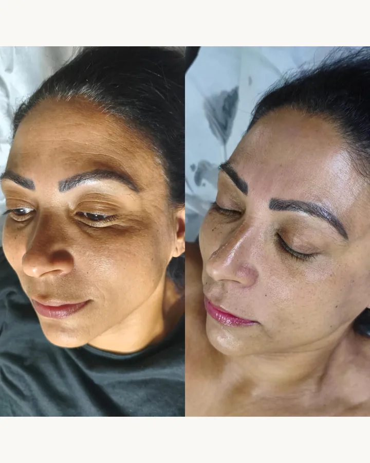 Protocolo DermAna: frascos de Renova Skin, Sérum Clareador e Sabonete Renovador, foto 2 de 4
