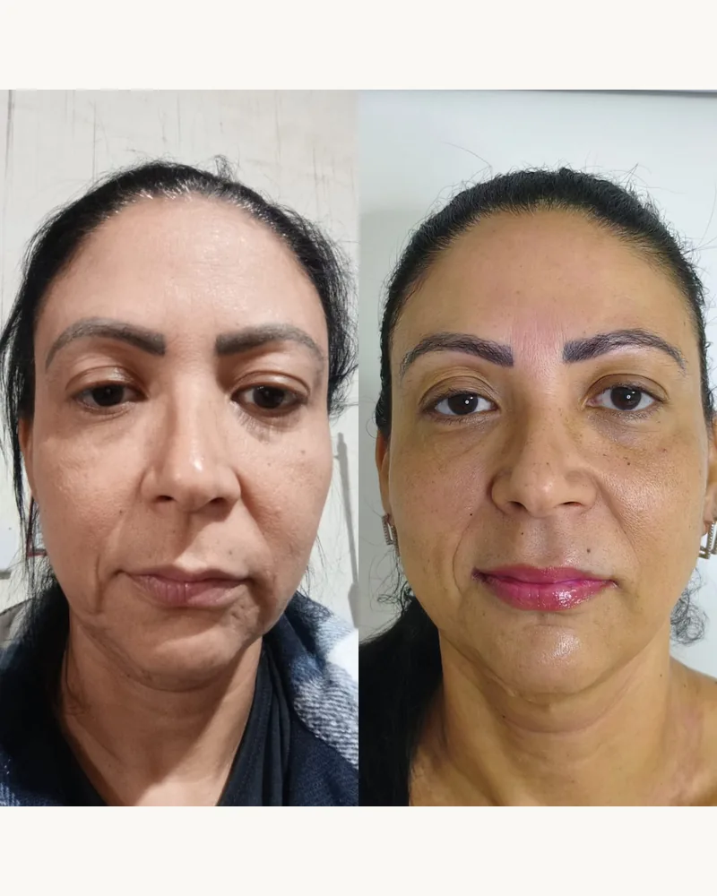 Frasco Renova Skin DermAna, 30 ml, preto e dourado, foto 3 de 4